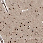 Anti-ZNF280D Antibody
