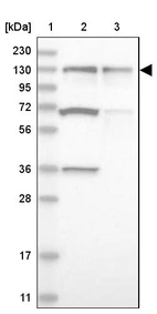 Lane 1: Marker [kDa] 230, 130, 95, 72, 56, 36, 28, 17, 11_br/_Lane 2: Human cell line RT-4_br/_Lane 3: Human cell line U-251MG sp