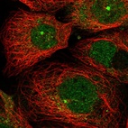 Immunofluorescent staining of human cell line A-431 shows localization to nucleoplasm, cytosol & centrosome.