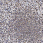 Anti-MX2 Antibody