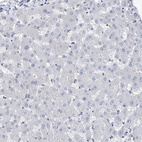 Immunohistochemical staining of human liver shows no positivity in hepatocytes as expected.