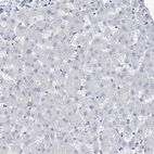 Immunohistochemical staining of human liver shows no positivity in hepatocytes as expected.