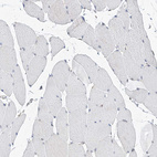 Immunohistochemical staining of human skeletal muscle shows no positivity in myocytes as expected.