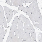 Immunohistochemical staining of human skeletal muscle shows no positivity in myocytes as expected.
