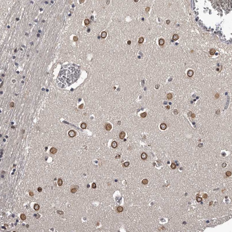 Anti-C1orf50 Antibody