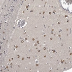 Anti-C1orf50 Antibody