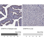 Anti-CFAP74 Antibody