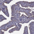 Immunohistochemical staining of human fallopian tube shows high expression.