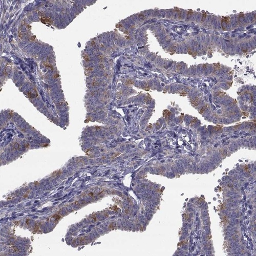 Anti-CFAP74 Antibody