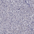 Immunohistochemical staining of human liver shows low expression as expected.