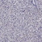 Immunohistochemical staining of human liver shows low expression as expected.