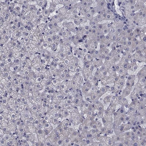 Anti-CFAP74 Antibody