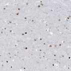 Immunohistochemical staining of human cerebral cortex shows moderate nuclear positivity in neurons.