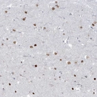 Immunohistochemical staining of human cerebral cortex shows moderate nuclear positivity in neurons.