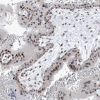 Immunohistochemical staining of human placenta shows moderate nuclear positivity in trophoblastic cells.