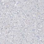 Immunohistochemical staining of human liver shows no positivity in hepatocytes as expected.