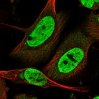 Immunofluorescent staining of human cell line U-251 MG shows localization to nucleoplasm.