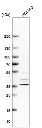 Western blot analysis in human cell line HDLM-2.