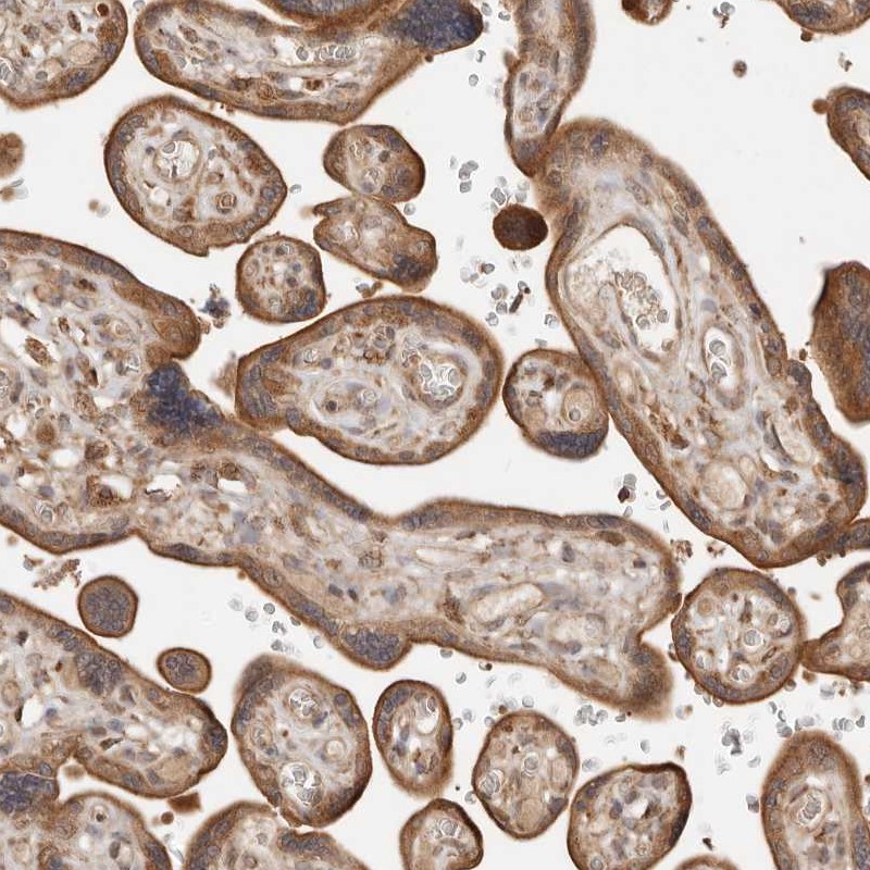 Anti-DACT2 Antibody