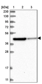 Lane 1: Marker [kDa] 230, 130, 95, 72, 56, 36, 28, 17, 11_br/_Lane 2: Human cell line RT-4_br/_Lane 3: Human cell line U-251MG sp