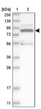 Lane 1: Marker [kDa] 230, 130, 95, 72, 56, 36, 28, 17, 11_br/_Lane 2: Human cell line RT-4