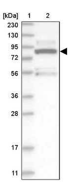 Lane 1: Marker [kDa] 230, 130, 95, 72, 56, 36, 28, 17, 11_br/_Lane 2: Human cell line RT-4