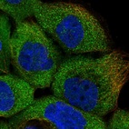 Immunofluorescent staining of human cell line A-431 shows localization to cytosol.