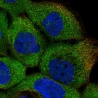 Immunofluorescent staining of human cell line A-431 shows localization to cytosol.