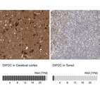 Anti-DIP2C Antibody