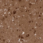Immunohistochemical staining of human cerebral cortex shows high expression.