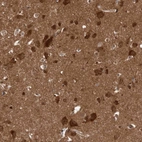 Immunohistochemical staining of human cerebral cortex shows high expression.