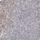 Anti-DIP2C Antibody