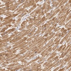 Anti-TFB2M Antibody