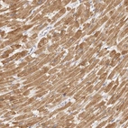 Anti-TFB2M Antibody