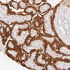 Anti-TRIM45 Antibody
