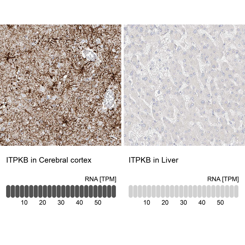 Anti-ITPKB Antibody