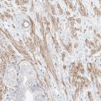 Immunohistochemical staining of human prostate shows strong cytoplasmic positivity in smooth muscle cells.