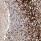 Immunohistochemical staining of human cerebellum shows strong cytoplasmic positivity in white matter.