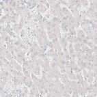 Immunohistochemical staining of human liver shows no positivity in hepatocytes as expected.