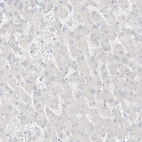 Immunohistochemical staining of human liver shows no positivity in hepatocytes as expected.