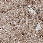 Immunohistochemical staining of human cerebral cortex shows strong cytoplasmic positivity in glial cells.