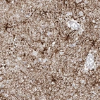 Immunohistochemical staining of human cerebral cortex shows strong cytoplasmic positivity in glial cells.