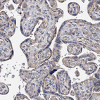 Immunohistochemical staining of human placenta shows moderate granular cytoplasmic positivity in trophoblastic cells.
