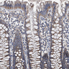 Anti-NRP1 Antibody