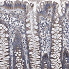 Immunohistochemical staining of human colon shows moderate granular cytoplasmic positivity in glandular cells.