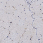 Immunohistochemical staining of human skeletal muscle shows low positivity in myocytes as expected.
