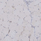 Immunohistochemical staining of human skeletal muscle shows low positivity in myocytes as expected.