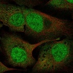 Anti-UFD1 Antibody