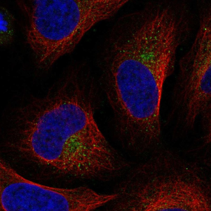 Anti-UFD1L Antibody