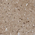 Anti-NCOA7 Antibody